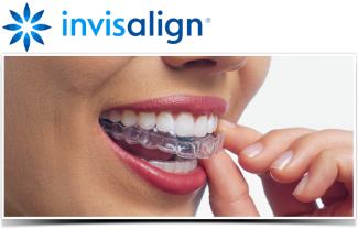 Invisalign